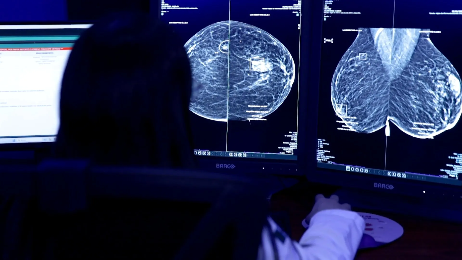 A clinician views breast scans on diagnostic monitors in a dimly lit room.