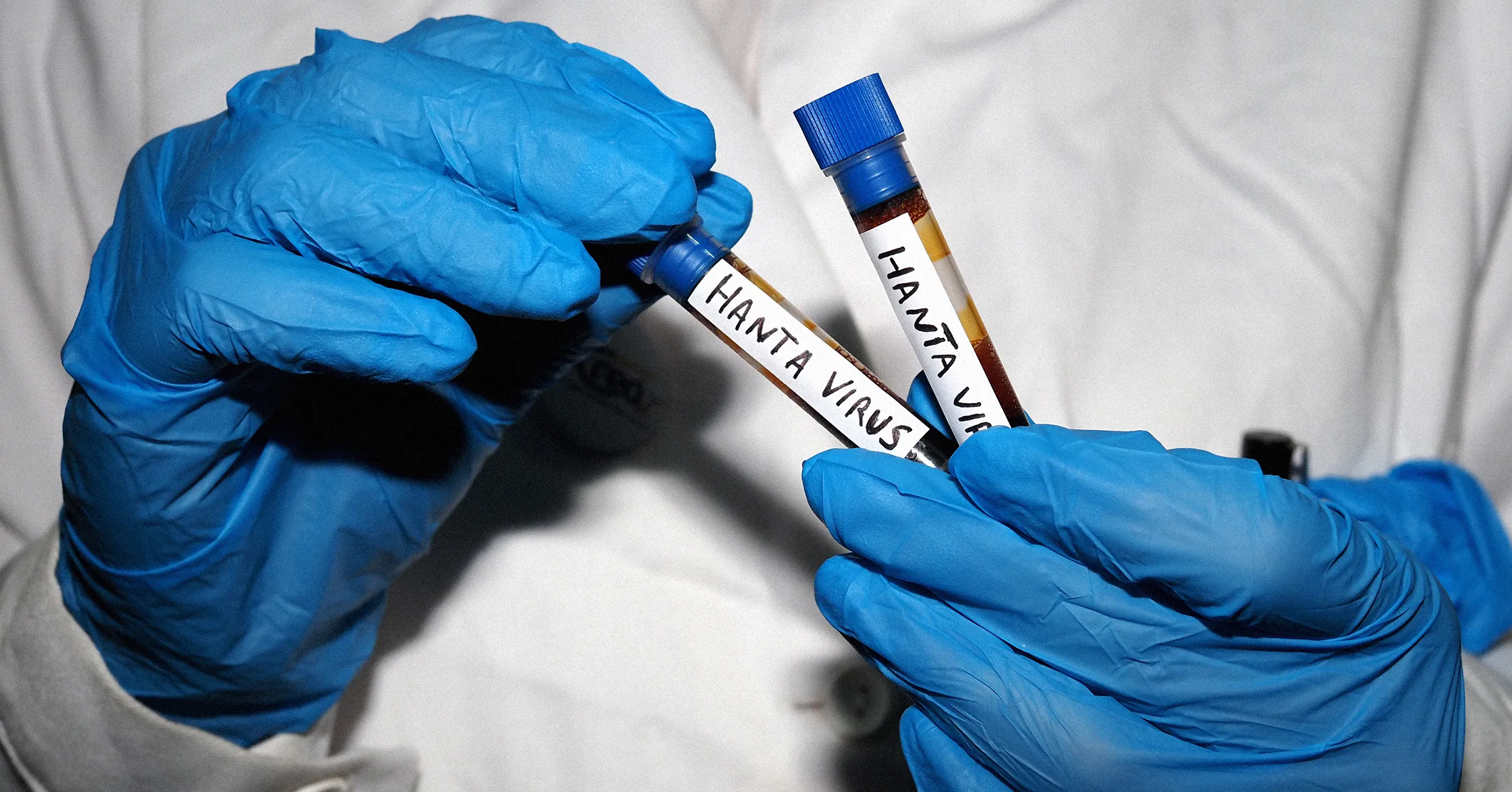 All Your Hantavirus Questions, Answered by an Infectious Disease Expert