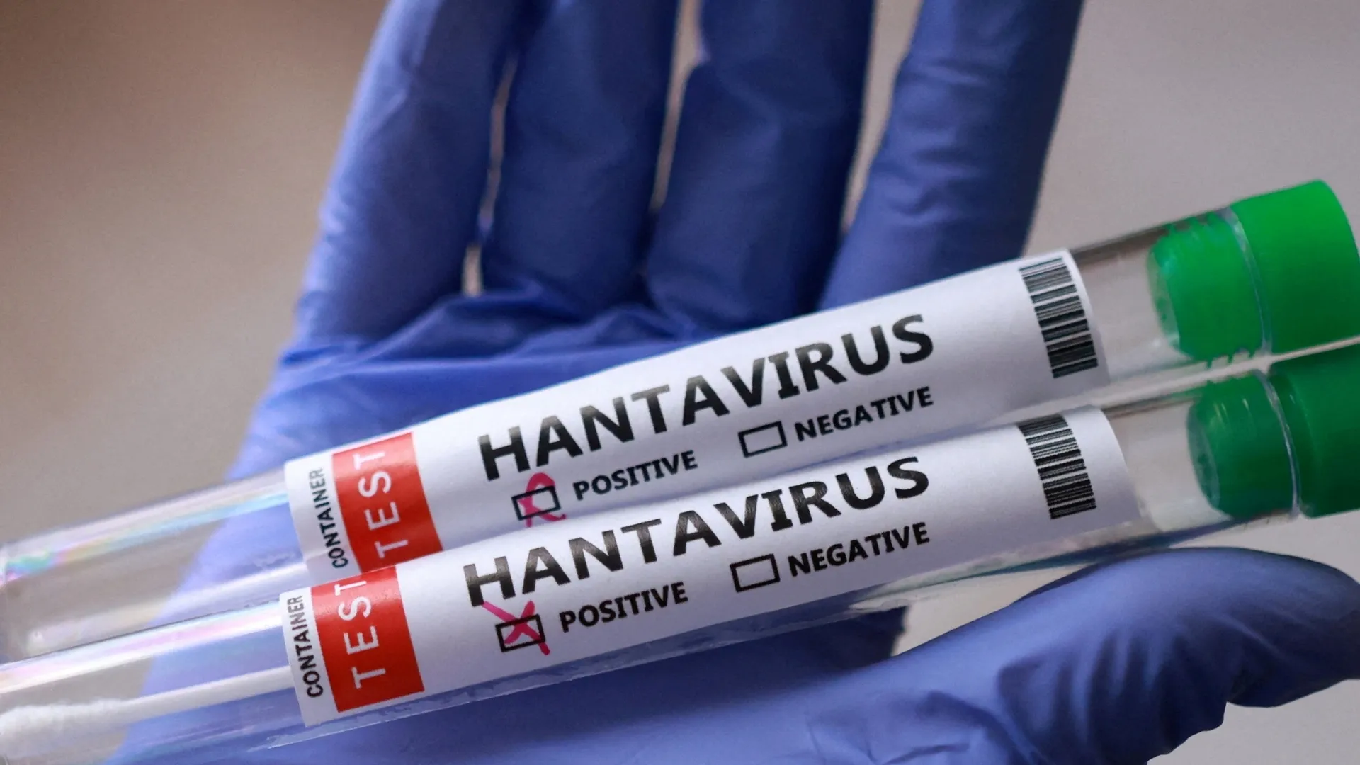 Should we be worried about the hantavirus outbreak?