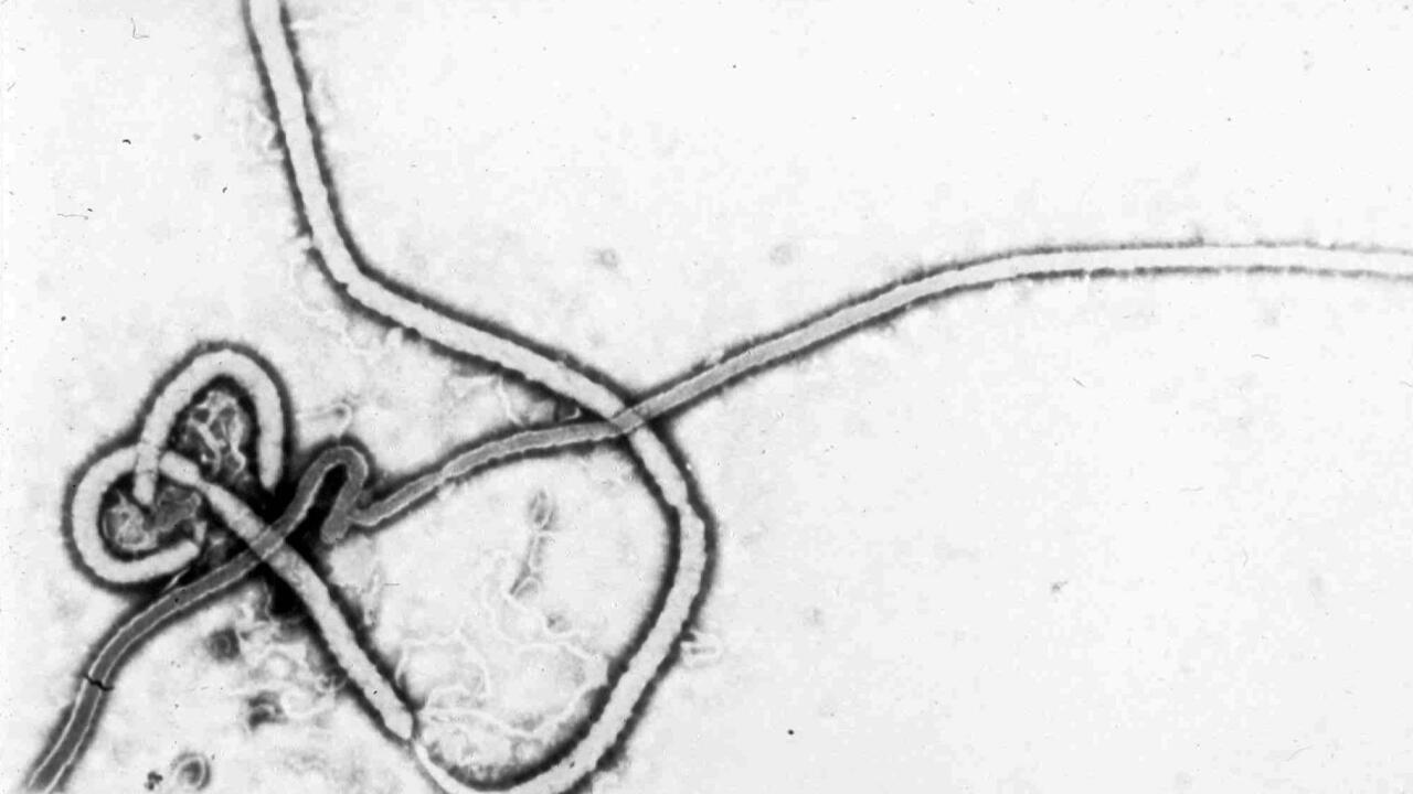 🔴 France confirms first Ebola case in doctor returning from humanitarian mission in DR Congo