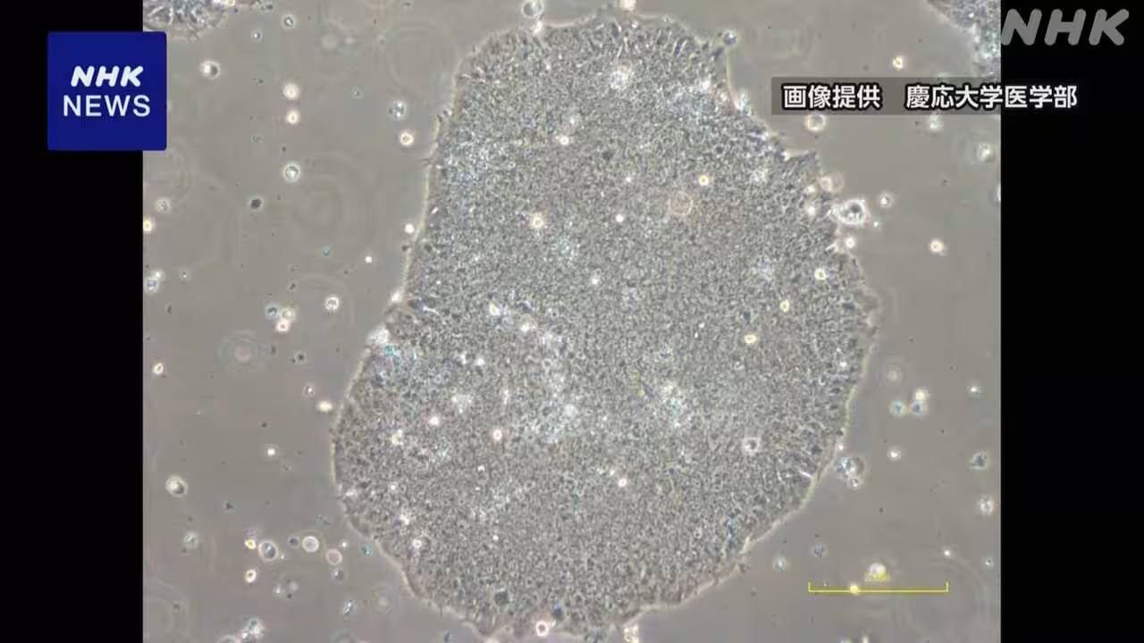 iPS脊髄損傷治療の研究 長期でも悪化せず安全性確認
