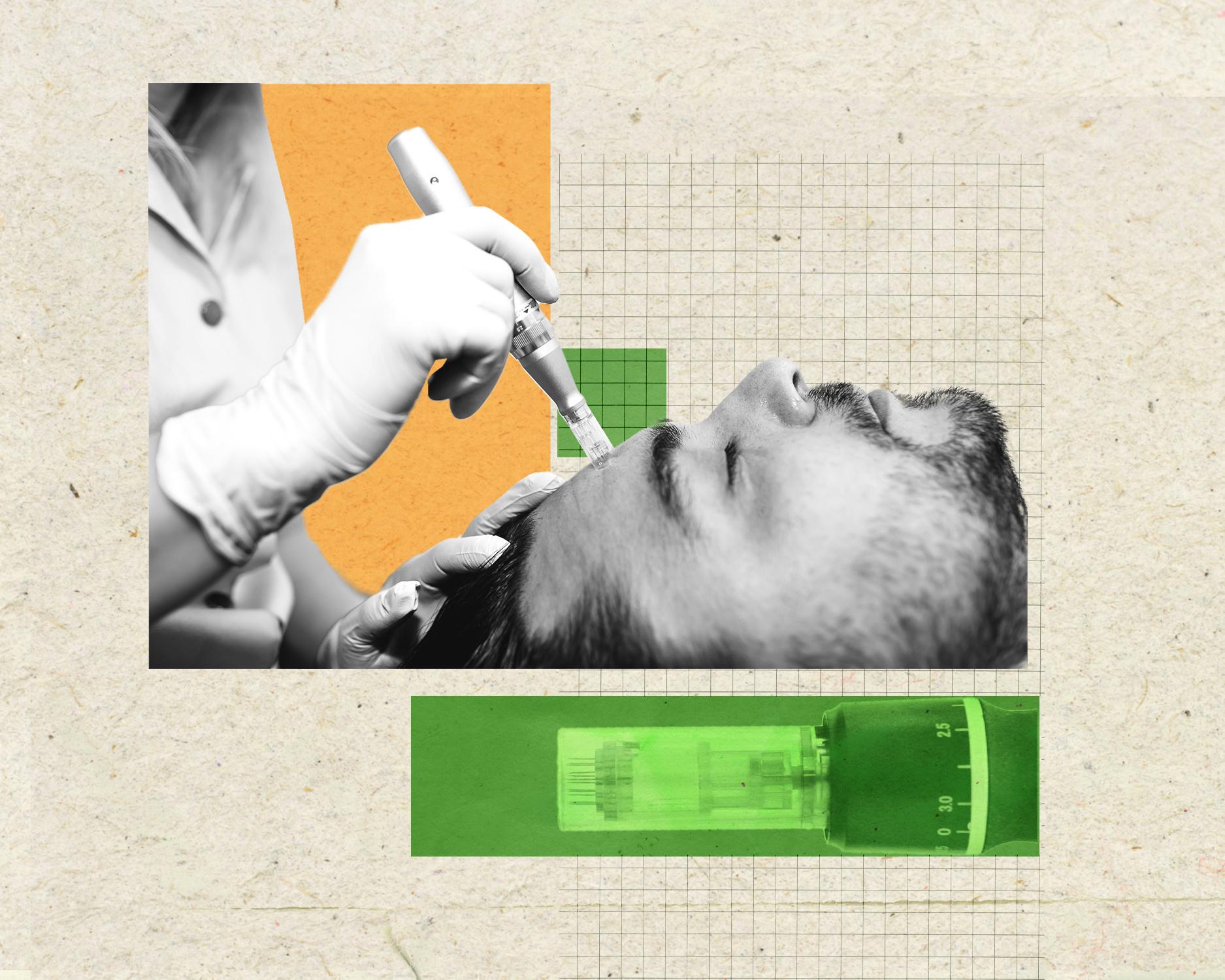 Does microneedling work? I’ll wait for better evidence before repeatedly stabbing my face | Antiviral