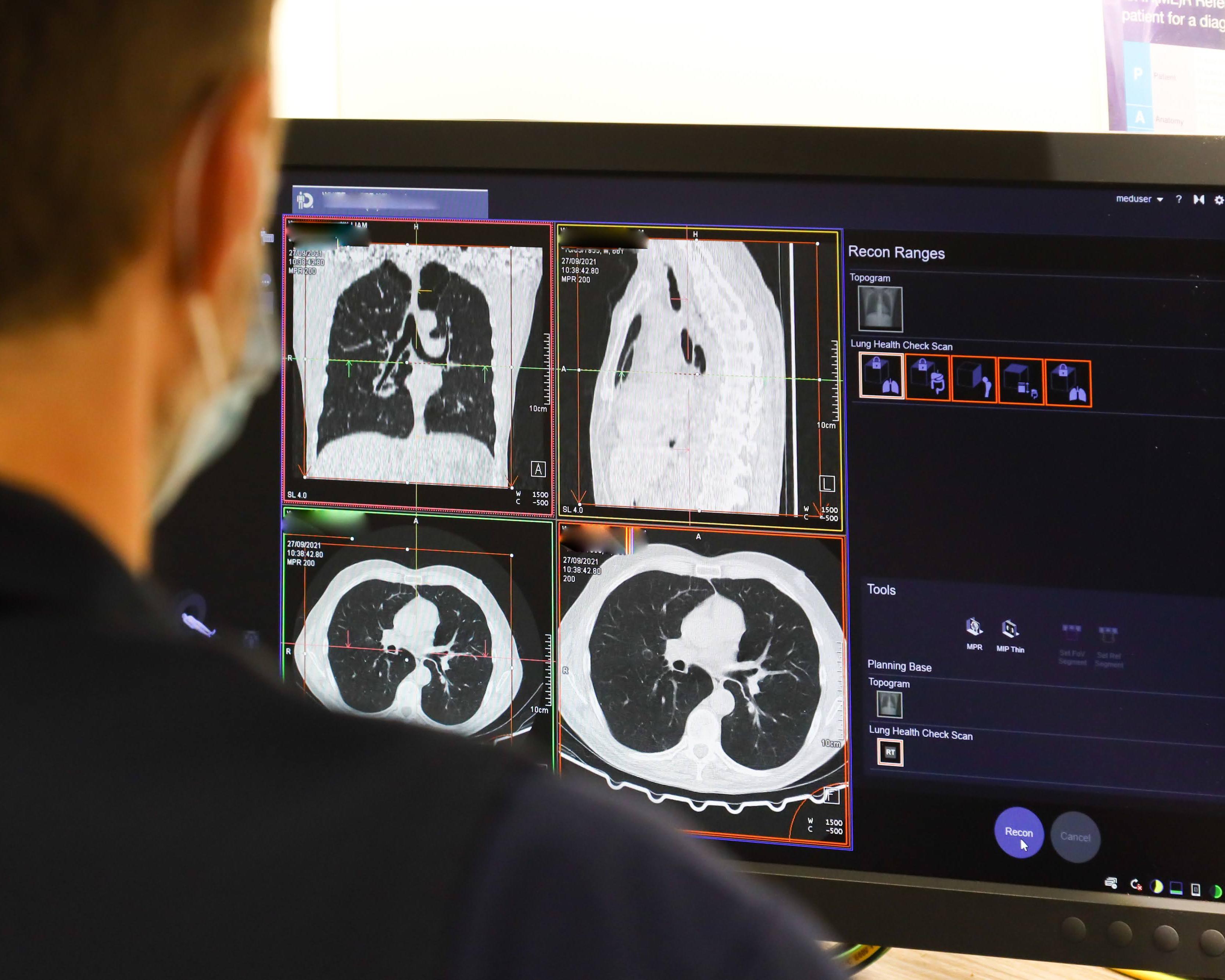 NHS spends record £241m outsourcing scan analysis to private firms