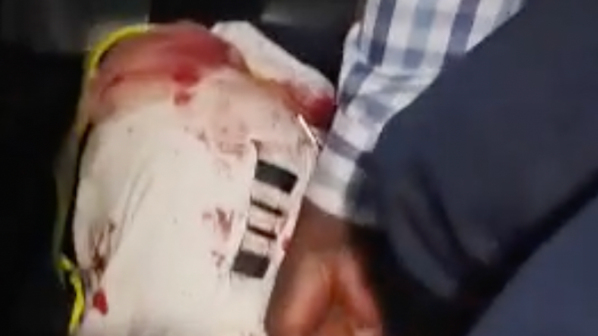 A person holds a bloodied white cap with dark stripes beside someone wearing a checked shirt.