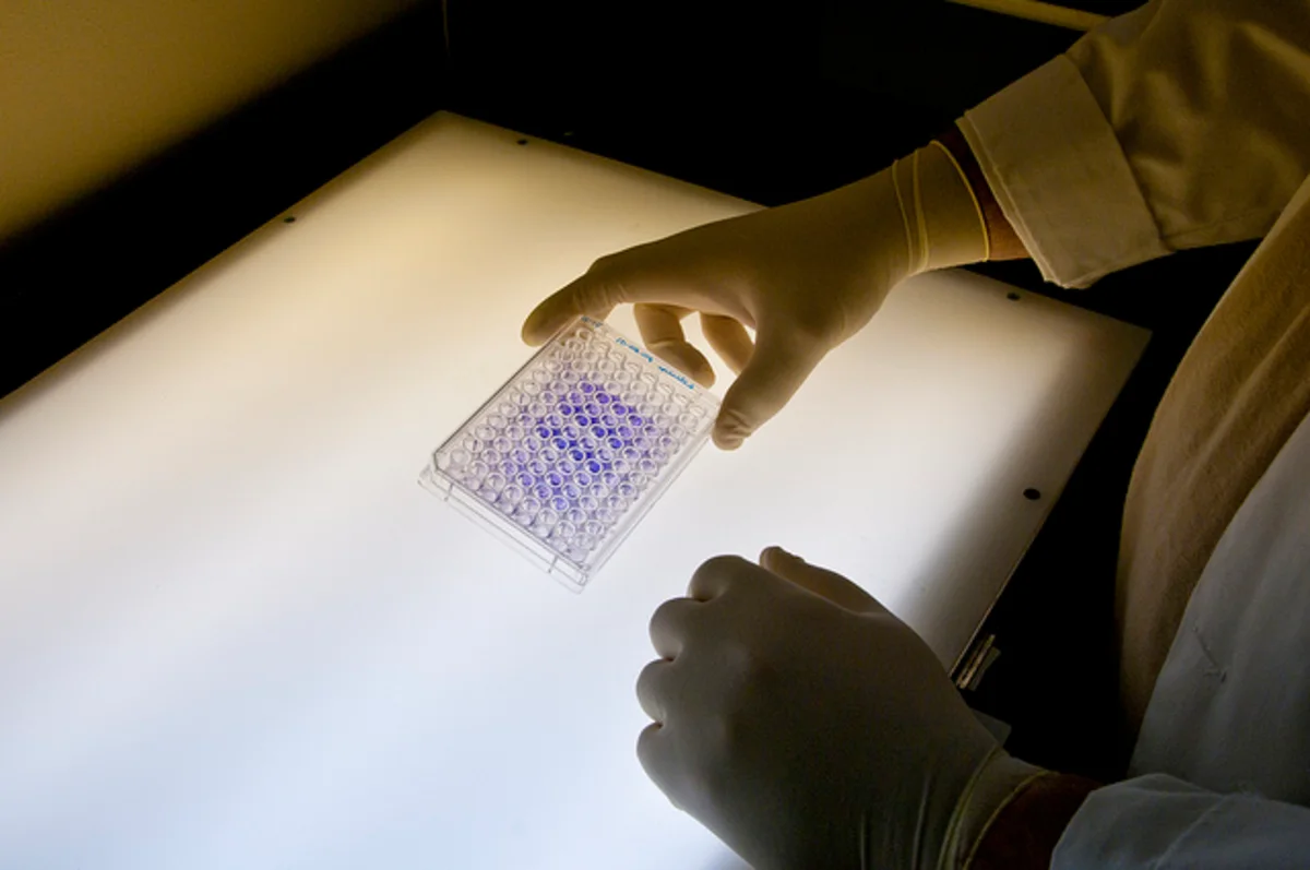 Gloved laboratory worker examines a microplate containing purple liquid samples over an illuminated surface.
