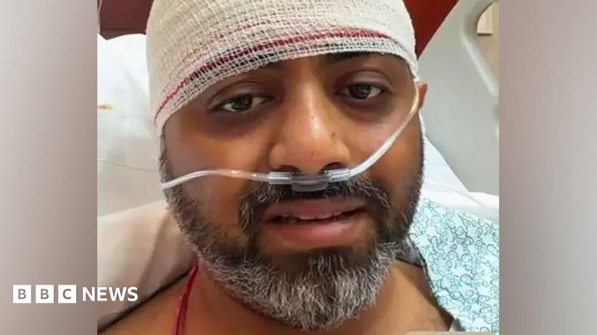 Bearded man with a bandaged head and nasal oxygen cannula lying in a hospital bed.